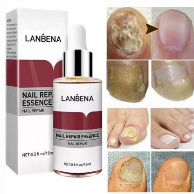 Lambina nail repair essence-1pcs