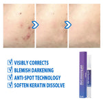 Wart Removing Pen