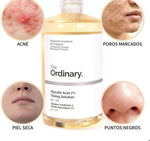 The Ordinary Glycolic Acid 7% Toning Solution