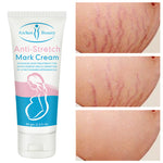 Anti-stretch Mark Cream