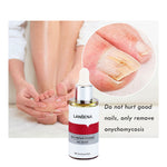 ফুলকোর্চ-Lambina nail repair essence-3pcs