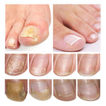 Lambina nail repair essence-1pcs