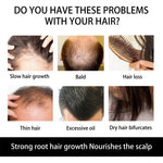 Derma Roller Microniddle Roller for Hair Growth