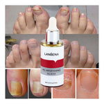 ফুলকোর্চ-Lambina nail repair essence-3pcs