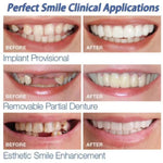 Adult Adjustable Dentures Teeth Set-1 pair