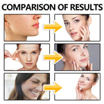 Collagen Serum for Face,Multi-Peptide Face Serum