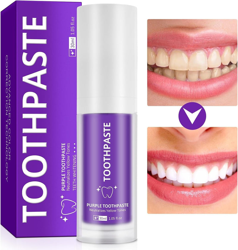 Purple Toothpaste – Teeth Whitening Colour Corrector Toothpaste