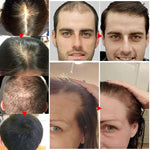Thailend-Ginger Hair Growth Serum