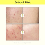 10% Niacinamide + 2% Arbutin-TIAM Vita B3 Source Serum