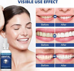 Cavity Healing Tooth Armor Liquid-30ml-1pcs