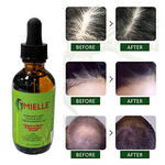 পারফেক্ট কম্বো!-Mielle Rosemary Mint Hair Growth Oil + Derma Roller